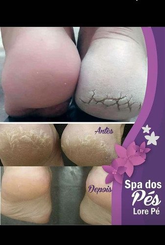 Método SPA dos Pés By Mirele Ramos - Imagem 3